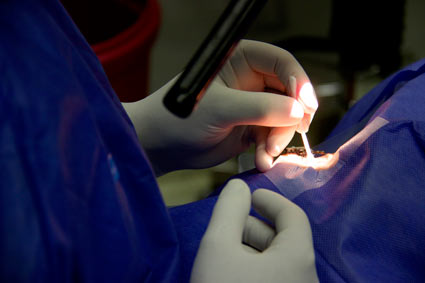 Lentes intraoculares